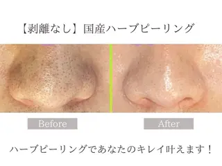 肌質改善サロン renew所属・肌質改善サロン renew/ウエキのエステ・リラクイメージ