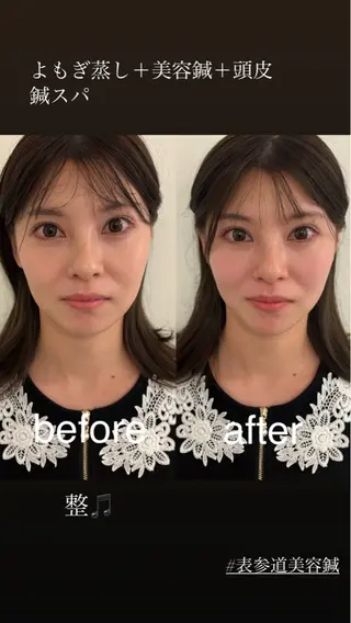 美容鍼灸サロン mahoroba院長のエステ・リラクイメージ