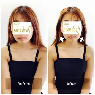 メディカルサロンドオフ所属・ハリサロンドオフ 美容鍼灸×小顔整体のエステ・リラクイメージ