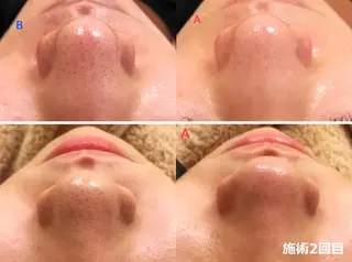 全身脱毛&VIO脱毛 紹介率№1♪リナ♪のエステ・リラクイメージ