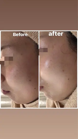 ショート カラー パーマ ヘアアレンジ メンズ キッズ ネイル マツエク・マツパ Amaryllis 🌹のエステ・リラクイメージ