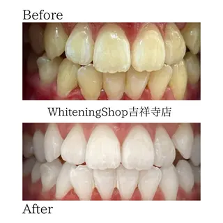 ホワイトニング ショップ吉祥寺店のエステ・リラクイメージ