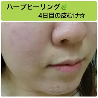 FLEUR大阪・美容 整体・痩身・小顔のエステ・リラクイメージ