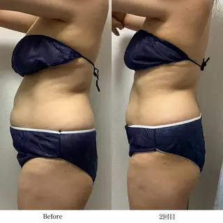 冷却専門店 SLARIのエステ・リラクイメージ