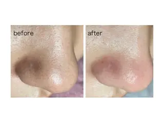 痩身Salon Charmeのエステ・リラクイメージ