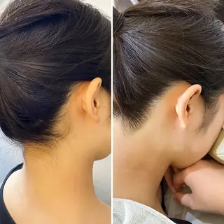 うなじ脱毛/美肌脱毛 LABELのエステ・リラクイメージ