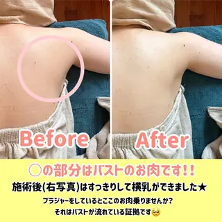 バストアップ専門/ ボディケア/小顔のエステ・リラクイメージ