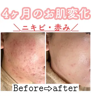 都度払い肌改善専門店 店長二上文香のエステ・リラクイメージ