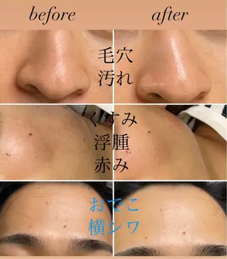 total beauty salon Raffoler所属・Raffoler りさのエステ・リラクイメージ