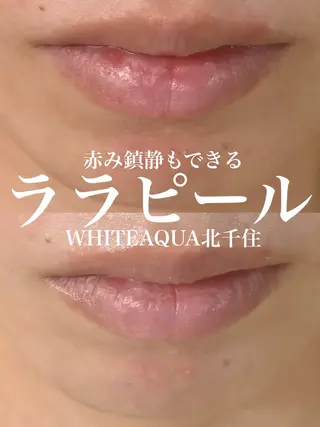 WHITE AQUA 北千住店のエステ・リラクイメージ