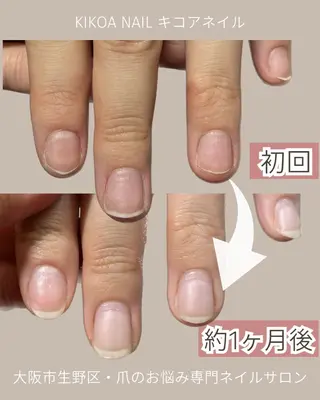 ネイル KIKOA NAIL キコアネイルのネイルデザイン