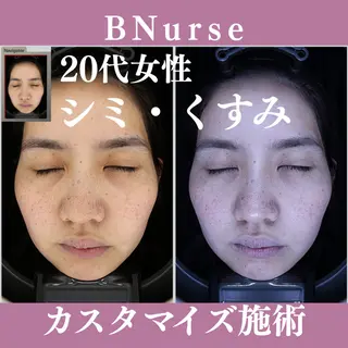 マツエク・マツパ 肌診断×韓国肌管理 by美容看護師のエステ・リラクイメージ