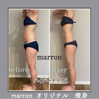 marron所属・痩身ハイパーナイフ ララピールリアボーテのエステ・リラクイメージ