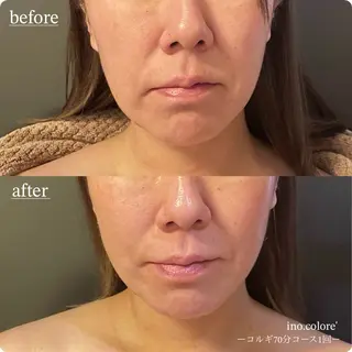 エステサロンino.colore'所属・小顔サロン ino.coloreのエステ・リラクイメージ