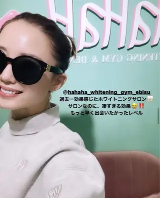 HaHaHa ホワイトニングのその他イメージ