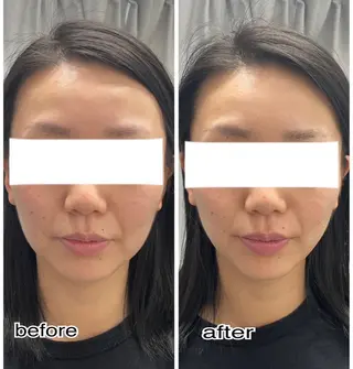 ENCHANT Kaede/肌質改善のその他イメージ