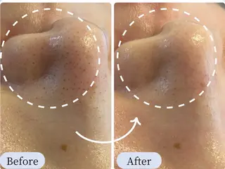 Detox Salon〜Lani Blue〜所属・卒業できるフェイス ワックス専門店のエステ・リラクイメージ