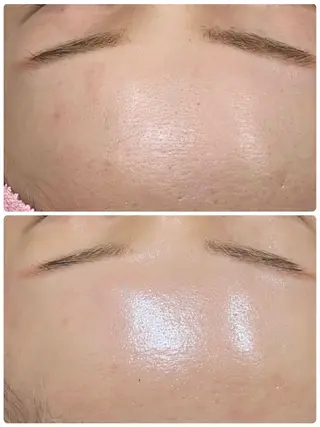 エステ矢野 ジョアアンジェ心斎橋のエステ・リラクイメージ