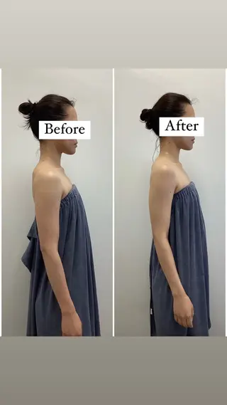 hari salon de off 美容鍼灸×小顔整体【ハリサロンドオフ】所属・美容鍼×小顔整体🤍 ishibashiのエステ・リラクイメージ