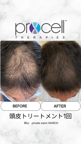 WARCH Marieのその他イメージ