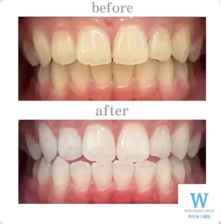 ホワイトニング ショップ本八幡店のエステ・リラクイメージ