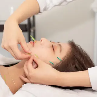 新宿hari-me所属・美容鍼hari-me 新宿のエステ・リラクイメージ