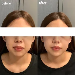 エステサロンino.colore'所属・小顔サロン ino.coloreのエステ・リラクイメージ