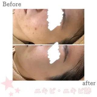 ミディアム カラー パーマ ヘアアレンジ メンズ キッズ ネイル マツエク・マツパ ニキビ&跡改善サロン オーナー光木のエステ・リラクイメージ