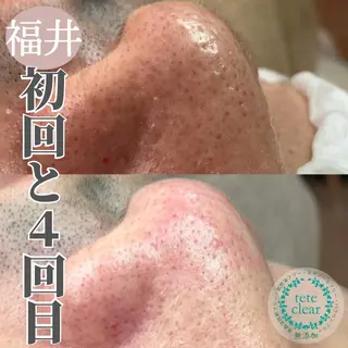 毛穴ケア専門サロン Yourmeユアミーのエステ・リラクイメージ