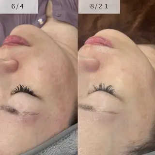 Venus所属・エステサロン Venusのその他イメージ