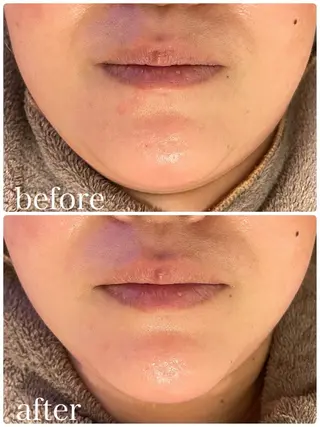 Smile beauty labのエステ・リラクイメージ