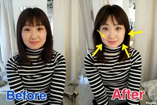 鍼灸整骨院Refine所属・鍼灸 Refineのその他イメージ