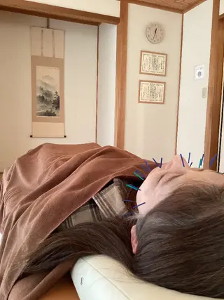 なかむら鍼灸院所属・なかむら 鍼灸院のエステ・リラクイメージ