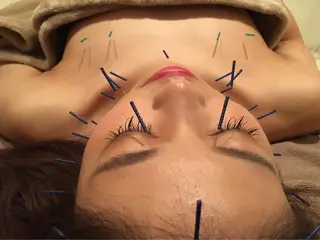 美容鍼サロン    Fleurir所属・伊藤 かなえのエステ・リラクイメージ