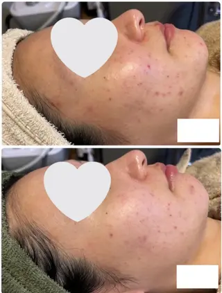 ピーリング専門店 Belluteのエステ・リラクイメージ