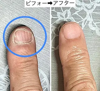 メンズ ネイル ハンドケア＆ネイルケア桃の木所属・ケアリスト🍀 マリユキのその他イメージ