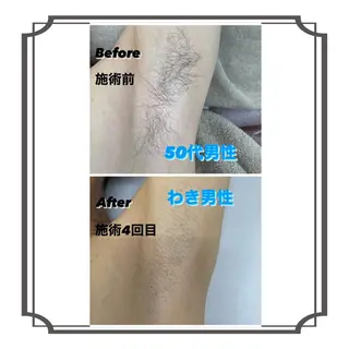 メンズ ホワイトニングサロン プレジールのエステ・リラクイメージ