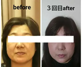 小顔と美肌 まごころエステMatoria所属・小顔 美肌専門 Matoriaのエステ・リラクイメージ