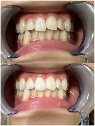 ホワイトニングジム 池袋のその他イメージ