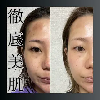 LiZA エステティックサロンのエステ・リラクイメージ