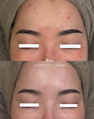Mau beauty salon所属・Mau (マウ)のエステ・リラクイメージ