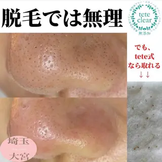 private salon  Dea_maris シュガーリング＆パーソナルボディケア所属・シミ改善・韓国肌管理 ボディメイク痩身のその他イメージ