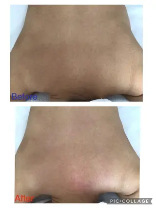 子宮矯正/腸揉み/ シュガーリング脱毛のエステ・リラクイメージ