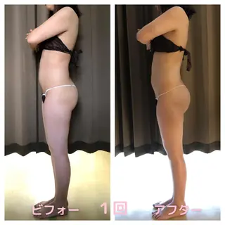 小顔・痩身専門店 Sunao所属・小顔.足痩せ整体 痩身天六Sunaoのその他イメージ