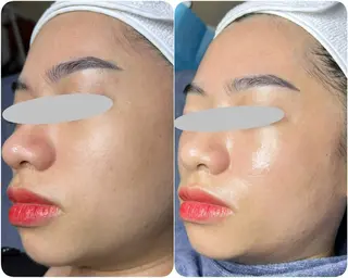 BIOLUXE BEAUTY所属・バイオラックス ビューティーのエステ・リラクイメージ
