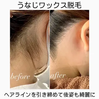 うなじ / 顔 / 眉毛 🥀rinaのエステ・リラクイメージ
