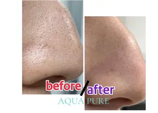 小顔・ツルツル素肌 ハリステリアのエステ・リラクイメージ