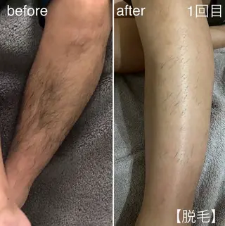 Feather TOMのエステ・リラクイメージ