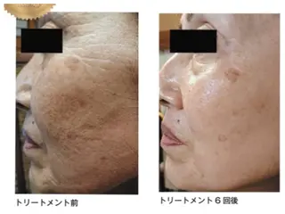 ﾄｰﾀﾙｽｷﾝｹｱ美容Room所属・トータルスキンケア 美容Roomのエステ・リラクイメージ