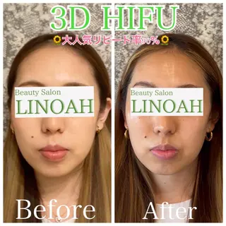 アイブロウ メンズ マツエク・マツパ ビューティーサロン リノアのエステ・リラクイメージ